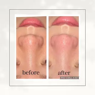 シミ・毛穴専門店 /gracia 安藤のエステ・リラクイメージ