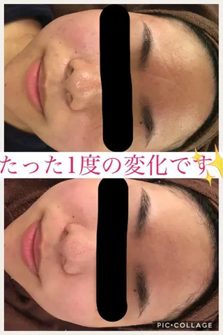 ショート カラー パーマ ヘアアレンジ メンズ キッズ ネイル マツエク・マツパ ニキビ・肌質改善専門 ♡人生が変わるサロンのエステ・リラクイメージ