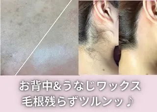 モン エピレなんば店のエステ・リラクイメージ