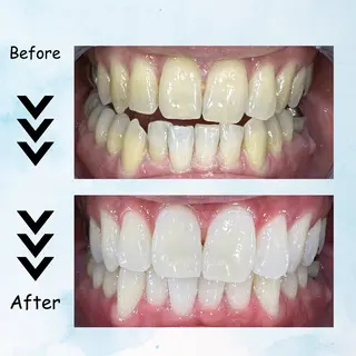 メンズ セルフホワイトニング エクシア塩釜口駅前店のその他イメージ