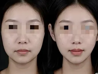 aliaハーブ水光店 エステティシャン募集のエステ・リラクイメージ