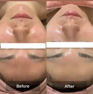 Eclavie所属・エクラヴィ 小顔・エイジングケアのエステ・リラクイメージ