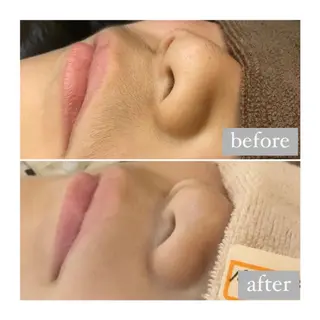 美肌脱毛専門サロン Dione栄店のエステ・リラクイメージ