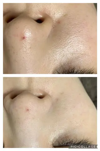 朝重い人専用 肩甲骨調整のエステ・リラクイメージ