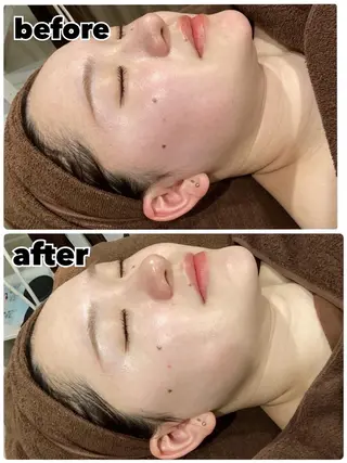 レイビス 渋谷店中野🤍のエステ・リラクイメージ