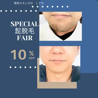 脱毛・痩身専門サロン LYN【リン】のエステ・リラクイメージ