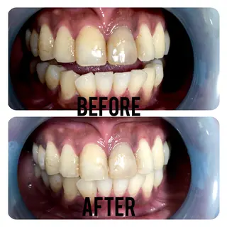 two nailのネイルデザイン