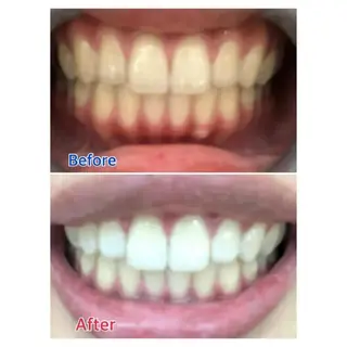 M渋谷 ホワイトニングのエステ・リラクイメージ