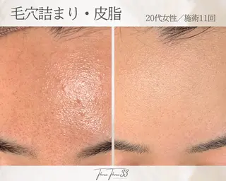 ピーリング×肌管理 THREETHREEのエステ・リラクイメージ