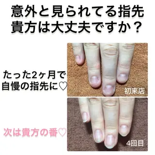 ネイル Nail×Lani 深爪矯正対応◎のネイルデザイン