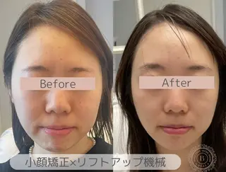 小顔/毛穴/ニキビ salon bealのエステ・リラクイメージ