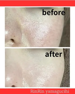 RinRin 山口店のエステ・リラクイメージ