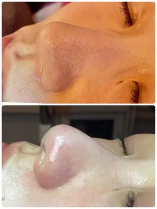 松下 千恵のネイルデザイン