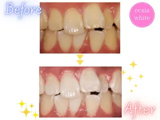 エクシアホワイト 🎀 SHINAのその他イメージ