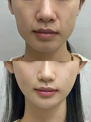 ネイル aliaハーブ水光店 エステティシャン募集のエステ・リラクイメージ