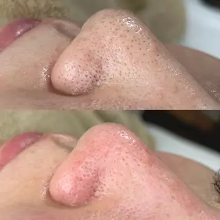 美肌脱毛&毛穴専門 Nico🐰ྀི♡のエステ・リラクイメージ