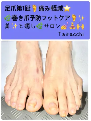 ネイル Tairacchi タイラッチのネイルデザイン