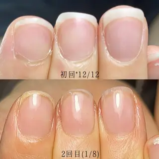 ネイル Aim* 深爪自爪育成専門店のネイルデザイン