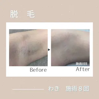 メンズ キッズ ainoa所属・ainoa アイノアのエステ・リラクイメージ