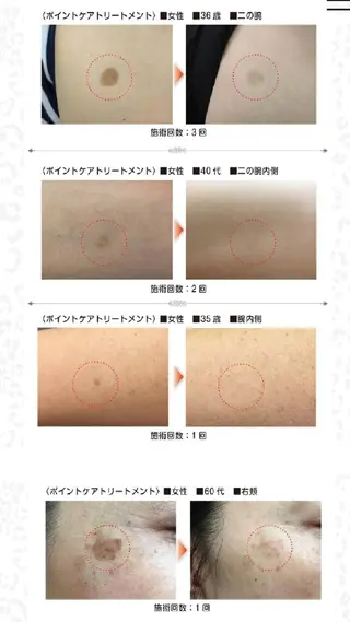 🅖🅤🅩🅔🅛 salonのエステ・リラクイメージ