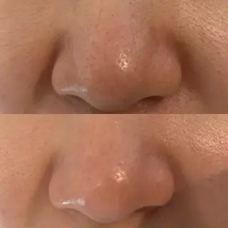 Del'm豊橋所属・豊橋De'Im 安部のエステ・リラクイメージ