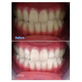 Ｍ渋谷 ホワイトニングのエステ・リラクイメージ