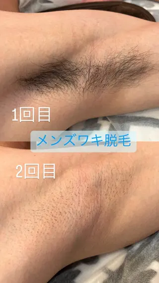 WAX・肌質改善・毛 穴洗浄/林愛真のエステ・リラクイメージ