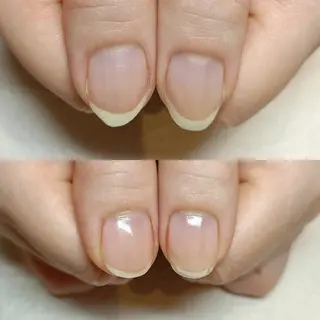 ネイル 深爪矯正/爪育成ケア manie nailのネイルデザイン