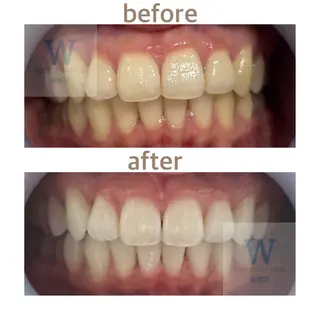 ホワイトニング ショップ船橋２号店のエステ・リラクイメージ