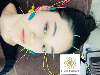 美容鍼専門鍼灸院 ハリエッセンスのその他イメージ