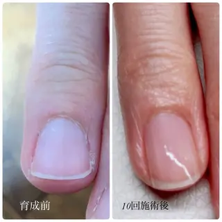 ネイル nailcare リリネルのネイルデザイン