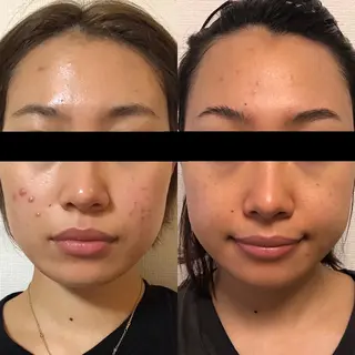 朝重い人専用 肩甲骨調整のエステ・リラクイメージ