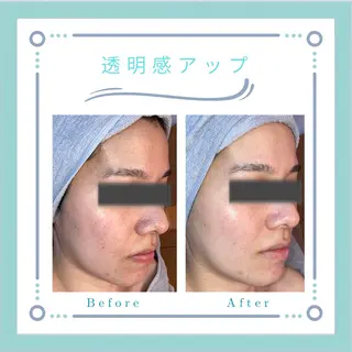 フェイシャルエステLe・Ciel所属・Le・Ciel フェイシャル&ボディのエステ・リラクイメージ