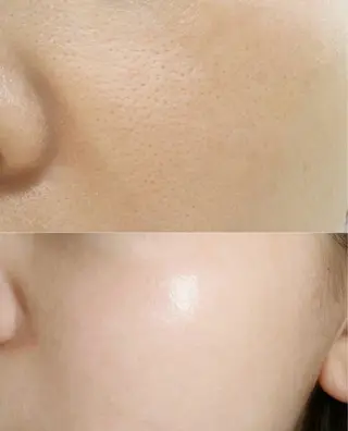 愛維美水光美肌専門店所属・愛維美水光美肌専門店 メンズレディースokのエステ・リラクイメージ