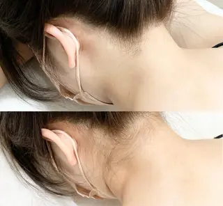 脱毛&ホワイトニング ELIXIR×ULTのエステ・リラクイメージ