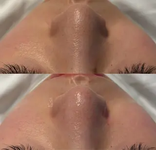 # fu♡のエステ・リラクイメージ