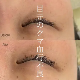 etre - 韓国肌管理 -のエステ・リラクイメージ