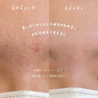 Yuuka 🍫🍓のマツエク・マツパデザイン