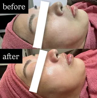 脱毛&美容サロン BLUESEAのエステ・リラクイメージ