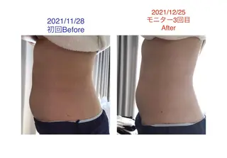 子宮矯正/腸揉み/ シュガーリング脱毛のエステ・リラクイメージ