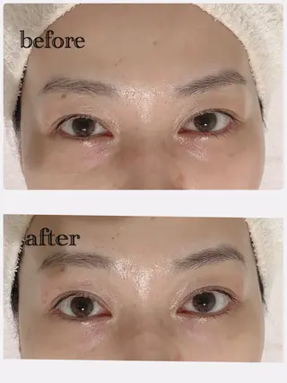 肌管理🌿毛穴改善 POLA堺東のエステ・リラクイメージ