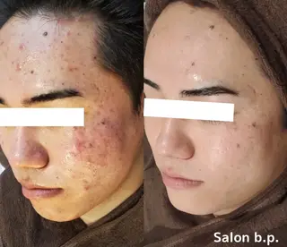 Salon b.p. 渋谷のエステ・リラクイメージ