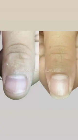 ネイル 深爪育成専門nail _Lumièlatのネイルデザイン