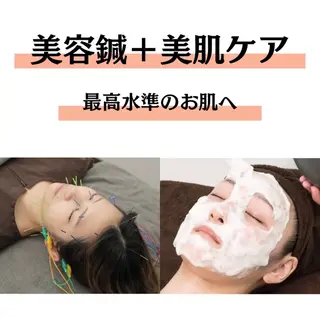 美容鍼灸×小顔整体♡ ハリサロンドオフ堺東のその他イメージ