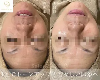 ハーブピーリング専門 サロンドレナ　白藤のエステ・リラクイメージ