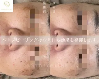 ハーブピーリング専門 サロンドレナ　白藤のエステ・リラクイメージ