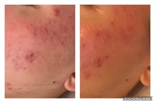 美肌とヘッド ナゴミプラスのエステ・リラクイメージ