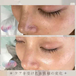 LBSホワイトニング 🌐岡山店のその他イメージ