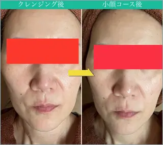 女性専用エステルーム Rerelaリレラのエステ・リラクイメージ