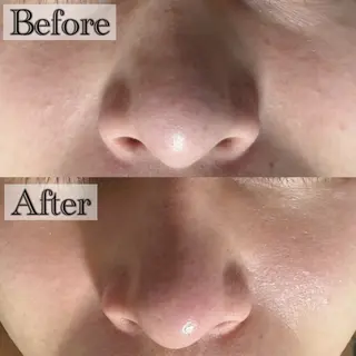 六本木/似合わせ眉毛 andＳ🍀Yuriのエステ・リラクイメージ